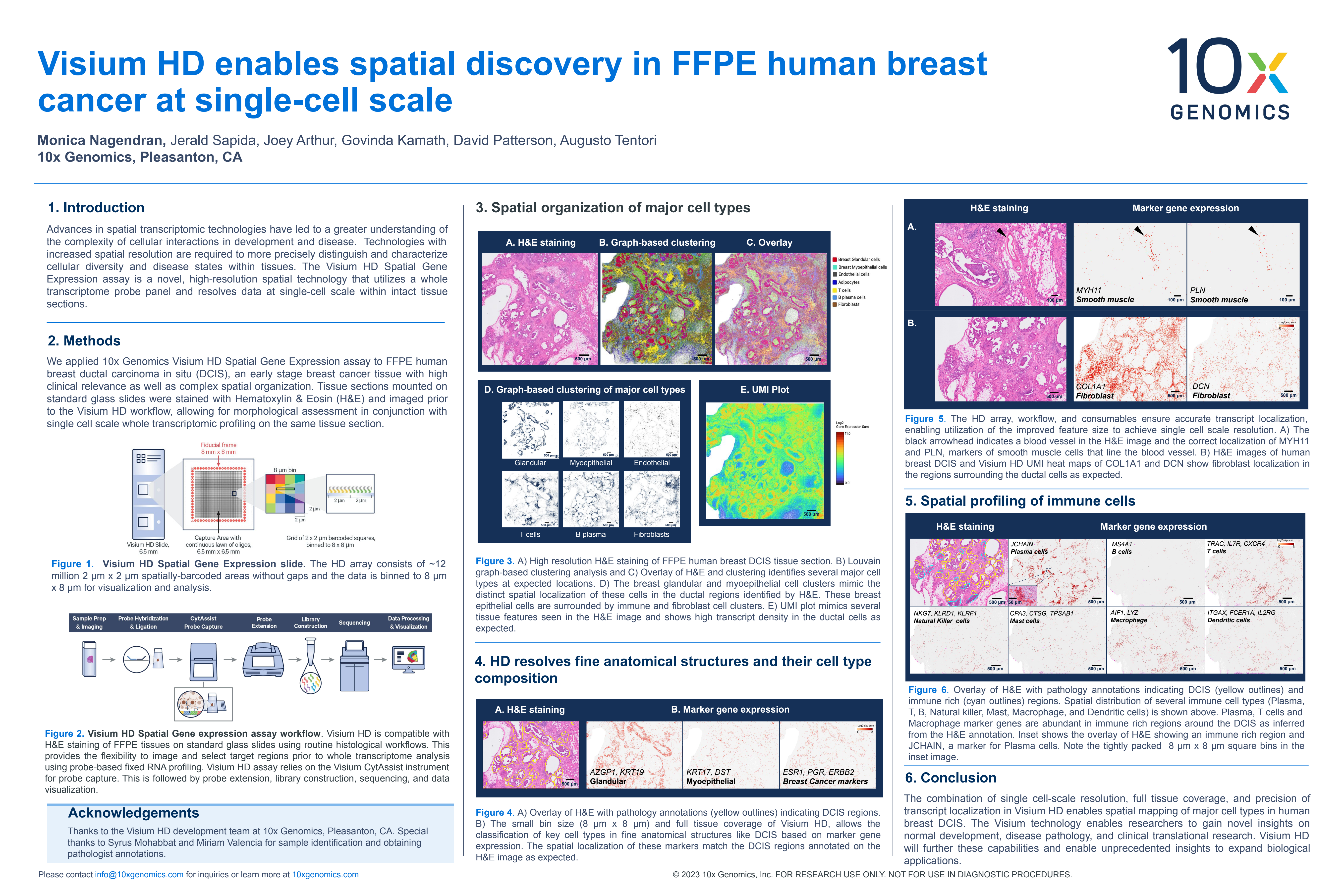Visium HD enables spatial discovery in FFPE human breast cancer at single-cell scale