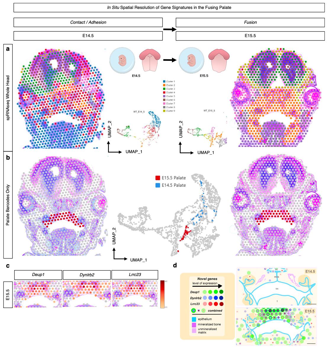Figure 5 from Piña J, et al. (3). Mid-palatal coronal cross sections of whole embryo heads were placed on barcoded Visium slides. A) In vivo clusters were defined from the whole embryo head, demonstrating spatial relationships and morphogenetic diversity of expression, further filtered for only those clusters encoded on the barcodes placed within the palate tissue in each respective section to identify top differentially expressed genes (DEGs) B) from E14.5 vs. E15.5 in the palate. C) Spatial gene expression feature plots for the three enriched genes identified. D) Colored circles correspond to 55 μm-diameter Visium transcriptomic resolution. Increased expression levels, delineated using the 10x Genomics Loupe Browser, are represented here with darker shades of green (Deup1), blue (Dynlrb2), or red (Lrrc23). The combined localization of these genes is indicated by overlapping concentric colored circles, the diameter of which does not correspond to degree of expression. nc nasal cavity, oc oral cavity, t tongue, mes midline epithelial seam; scale bar: 200 μm. CREDIT: Piña J, et al. (3). (CC BY 4.0)