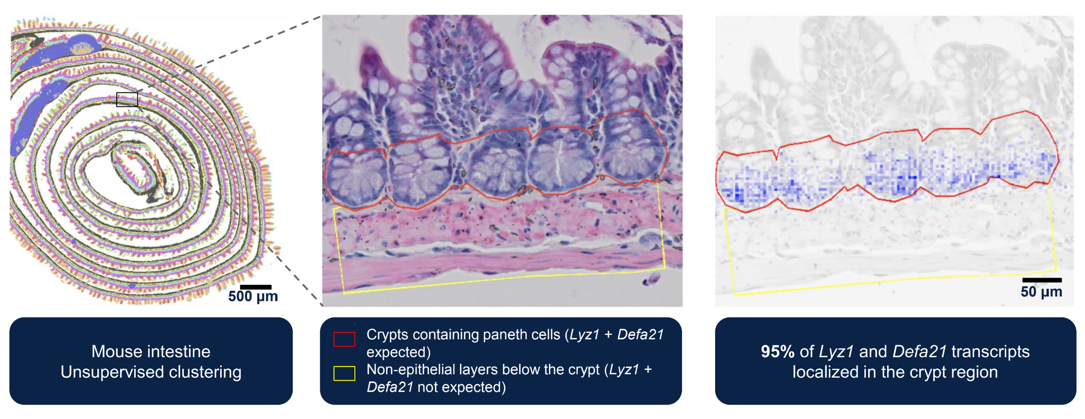 A demonstration of Visium HD’s ability to maintain spatiality and show the location of canonical marker genes in the expected locations within paneth cells in mouse intestinal crypts.