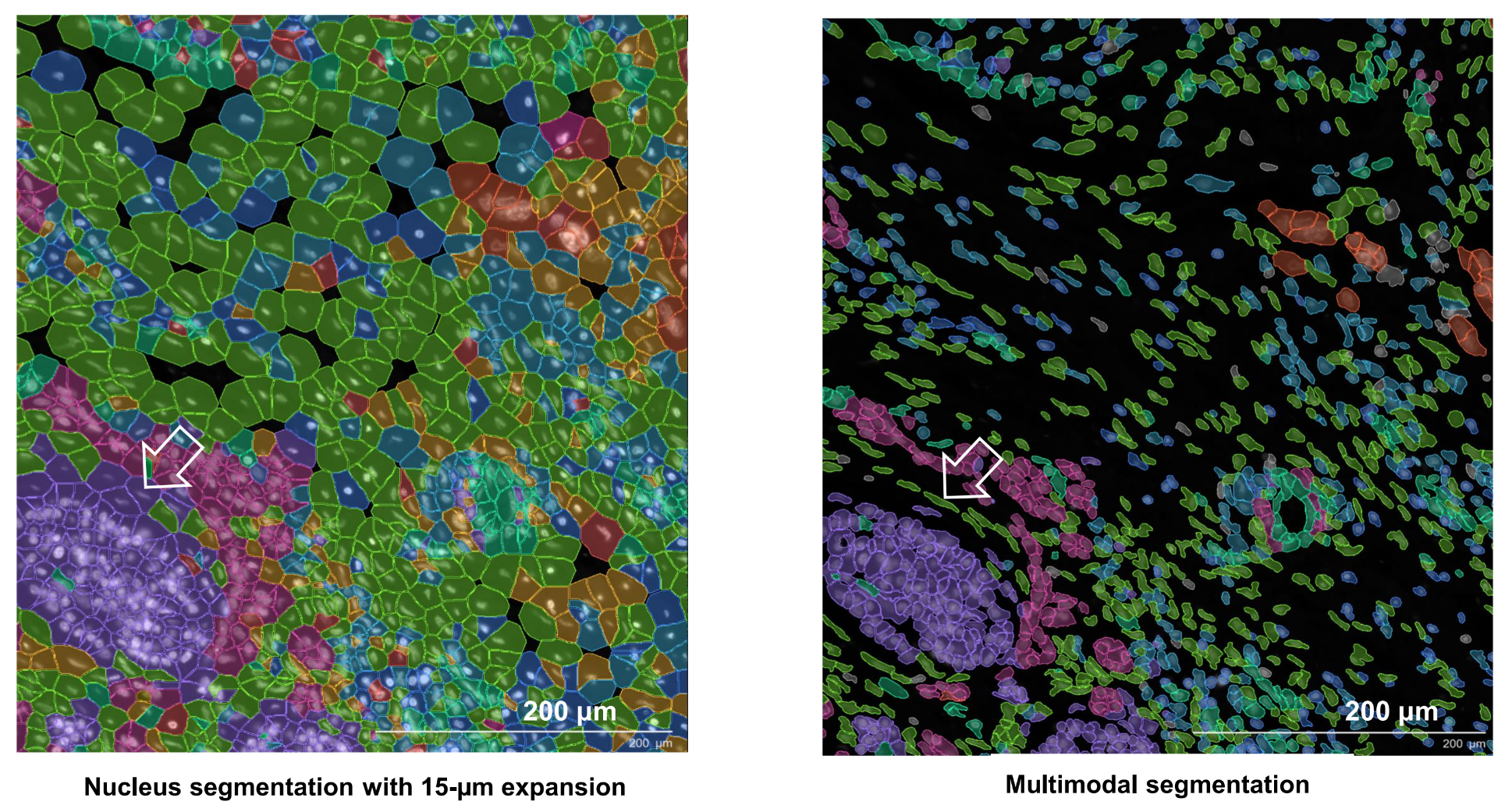 Comparison of segmentation results, with focus on fibroblasts (arrow), based on the nuclear expansion and multimodal approaches.
