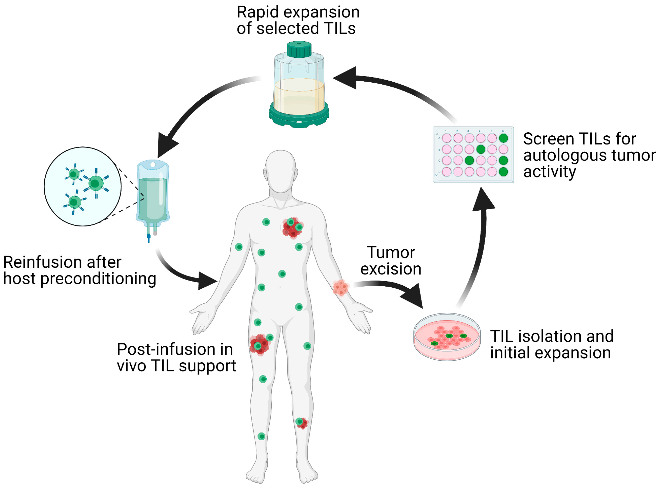 Schematic overview of the TIL-ACT protocol. Patients with metastatic tumors undergo metastasectomy of one lesion, which is then digested into multiple small tumor fragments or single cell suspensions. Tumor fragments are cultured with IL-2 in vitro for the initial TIL isolation and expansion. Isolated TILs are screened for tumor reactivity via co-culture with autologous digested tumor cells for IFN-γ secretion as assessed by IFN-γ ELISA. Tumor-specific TIL clones are then consolidated and rapidly expanded in the presence of anti-CD3 monoclonal antibody, IL-2, and irradiated autologous feeder cells. Once the number of TILs has reached treatment levels (typically > 1 × 10^10 cells), they are harvested and transferred back into a lymphodepleted host in one infusion. Credit: ACT Therapy for Solid Tumors, Scholarly Community Encyclopedia, https://encyclopedia.pub/entry/9312 (CC BY 4.0).