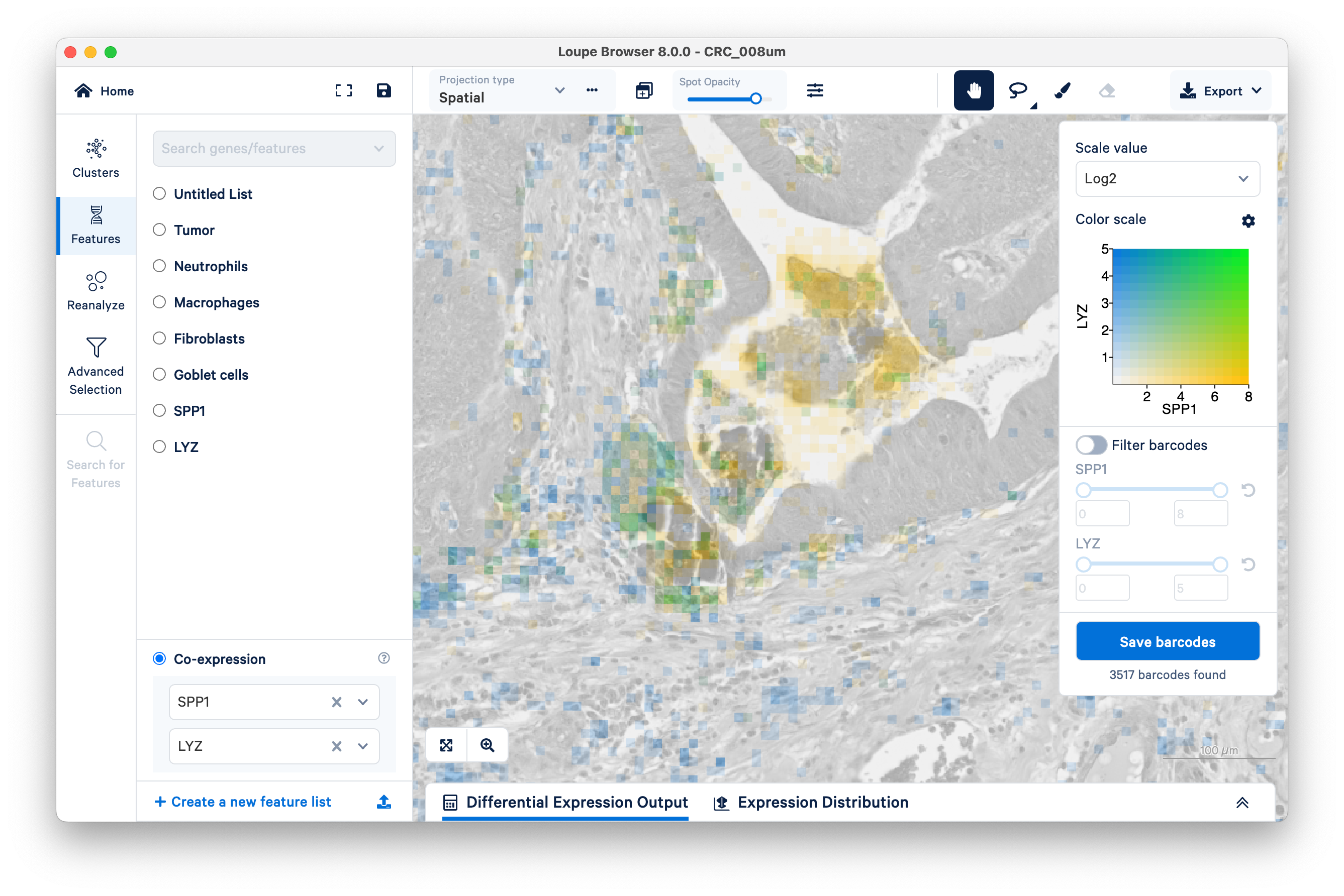 Mapping the Tumor Microenvironment with Visium HD and Loupe Browser ...