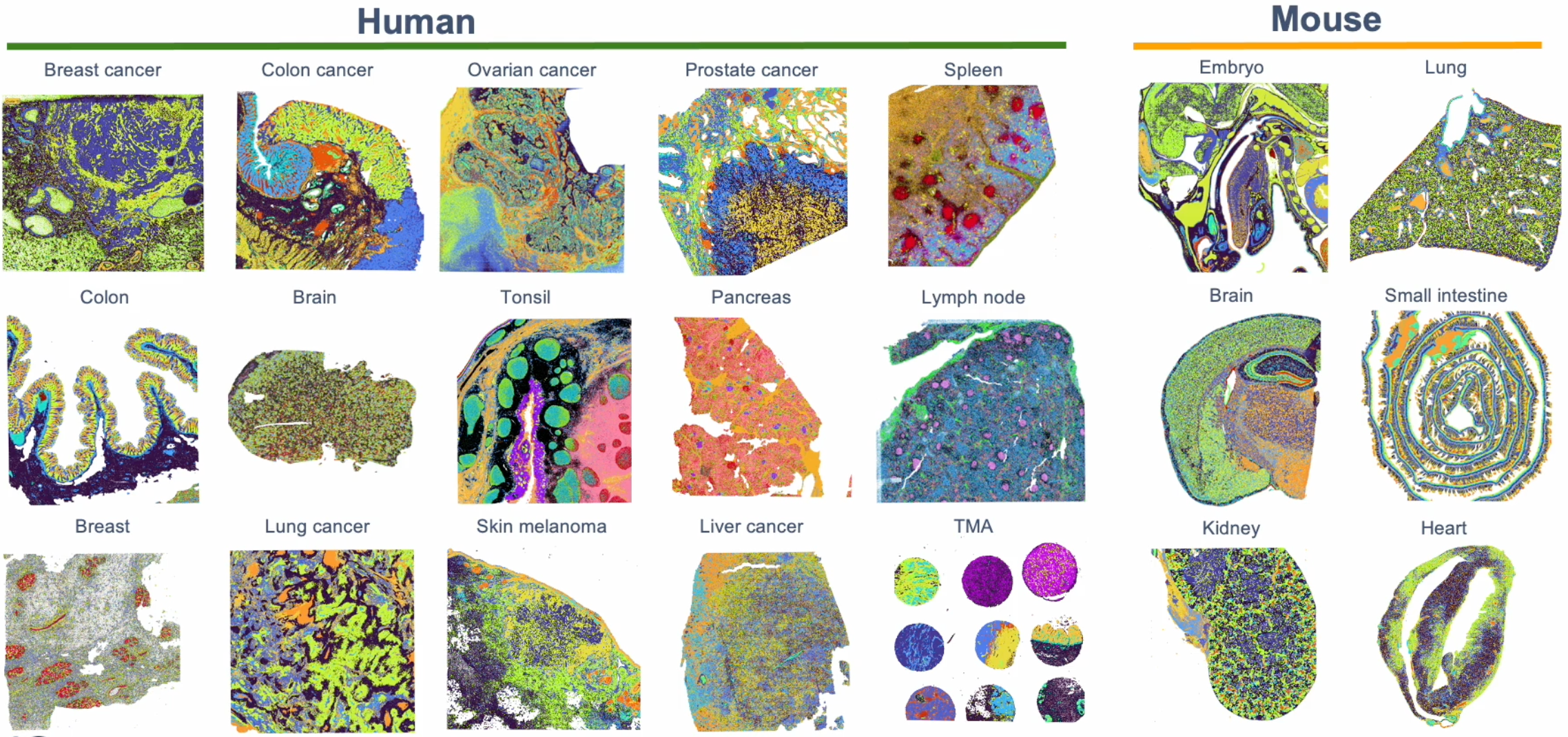 Figure 6. A collage of the human and mouse FFPE tissues that have been tested with the Visium HD assay. Of note, a number of challenging tissue samples, such as human spleen, have been tested and validated for Visium HD. Tissue microarrays (TMA) are also compatible with Visium HD.
