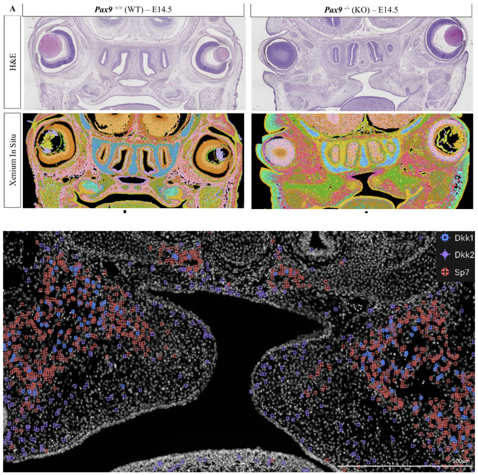 Figure 8. Using Xenium to transcriptomically and morphologically characterize palate in WT and Pax9-/- mice. (A) Coronal whole-head sections of embryonic WT and Pax9-/- mice processed with Xenium-based cell clusters (second row) and stained with H&E post-Xenium (first row). Spatial location of the Wnt modulators Dkk1 and Dkk2 (third row), showing distinct patterns of expression, as well as Sp7 (a palatine bone border marker). Image adapted from Figures 3 and 4 from Piña et al. 2023. (CC BY 4.0).