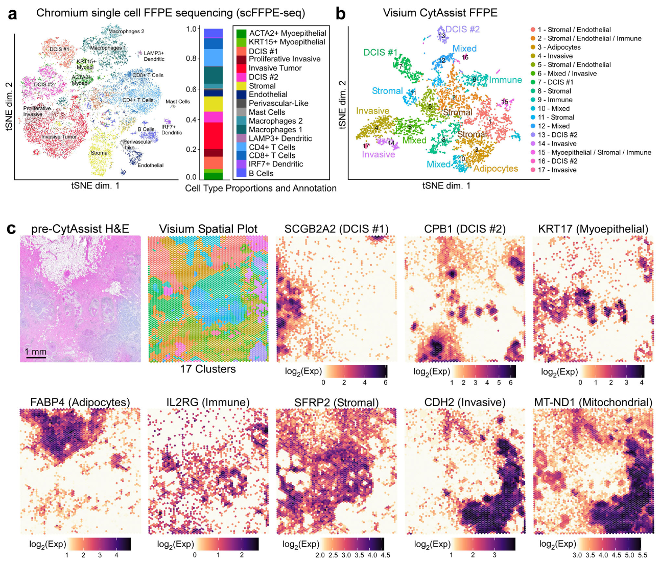 Figure 9. Characterization of an FFPE-preserved breast cancer sample using whole transcriptome single cell and spatial technologies. (a) Dimension reduction of the scFFPE-seq data yielded a t-SNE projection with 17 unsupervised clusters. (b) t-SNE projection of Visium spots also identifies 17 clusters. Based on differential gene expression analysis, ten clusters could be unequivocally assigned to cell types, while the others were mixtures of cell types. (c) H&E staining conducted pre-CytAssist is shown for reference alongside the spatial distribution of clusters in (b). Cell-type-specific marker genes are expressed as log2(normalized UMI counts). The Visium data elucidated the spatial location of two molecularly distinct DCIS and invasive subtypes and the general locations of immune, myoepithelial, adipocytes, and stromal cells. Additionally, Visium features mitochondrial probes (e.g., MT-ND1), and their spatial distribution correlates with the invasive region of the tissue section. This experiment was performed on two serial sections, with one representative section shown here. Image adapted from Figure 2 from Janesick et al. 2023. (CC BY 4.0). 