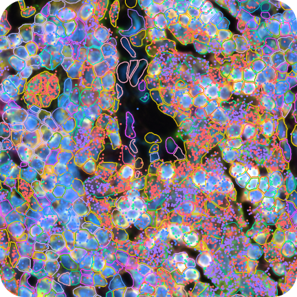 Preview Data: FFPE Human Lymph Node with 5K Pan Tissue and Pathways Panel