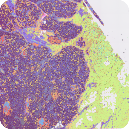 Visium HD Spatial Gene Expression Library, Human Pancreas (FFPE)