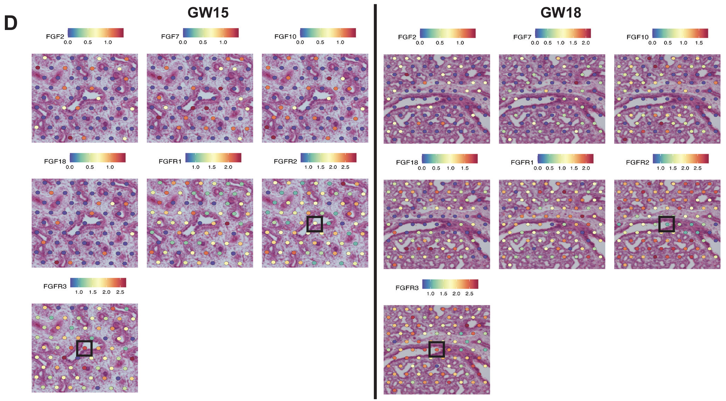 Figure 8. Expression of FGF ligands and receptors near triple-positive cells (black box on H&E staining) using Visium spatial transcriptomics. Credit: Supplementary Figure 10D from Quach H, et al. (3). CC BY 4.0.