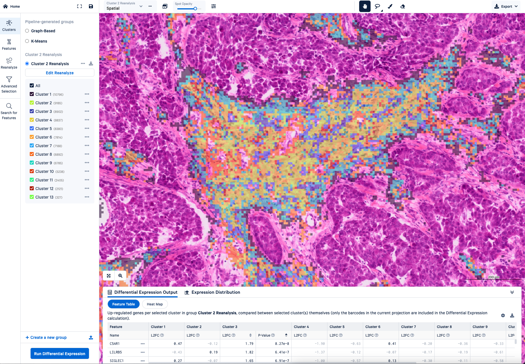 Screenshots of the reclustering workflow in Loupe Browser for the same Visium HD dataset (human FFPE breast cancer). Image 3.