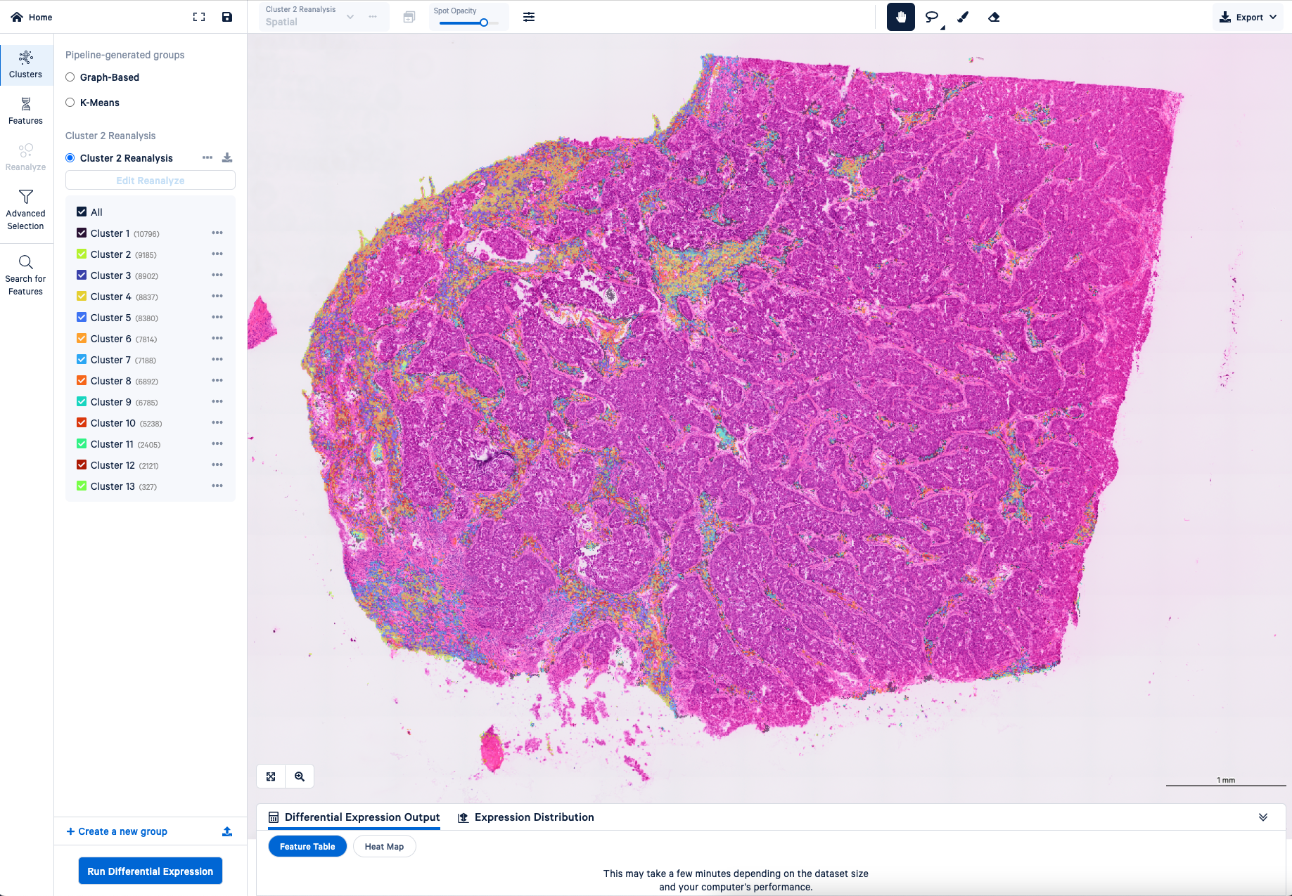 Screenshots of the reclustering workflow in Loupe Browser for the same Visium HD dataset (human FFPE breast cancer). Image 2.