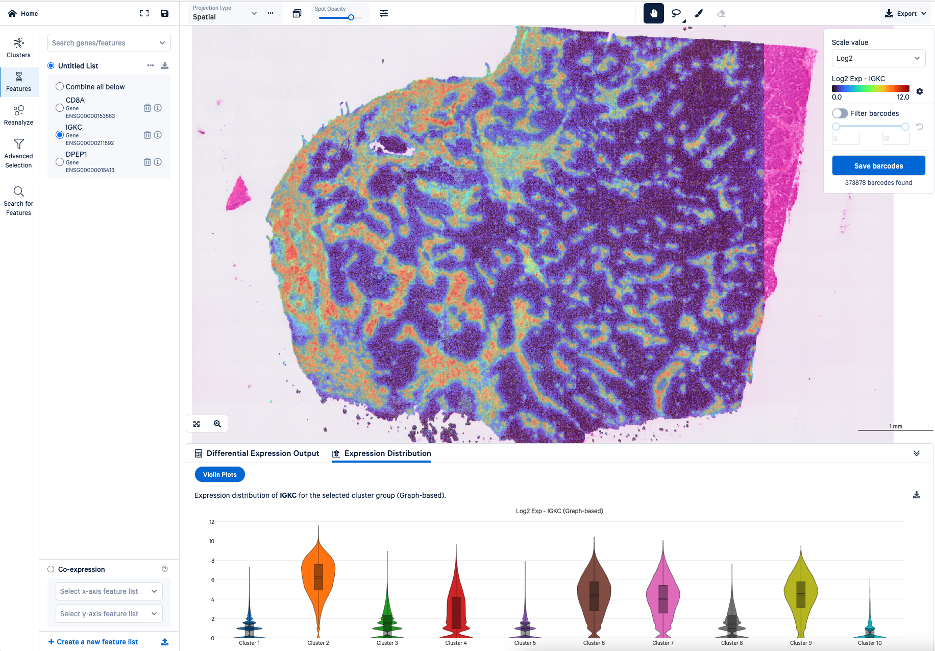 Visium HD data from a human FFPE breast cancer tissue section. This visualization in Loupe Browser shows the differential expression of the gene IGKC between clusters in a heat map overlaid on the tissue and in violin plots.