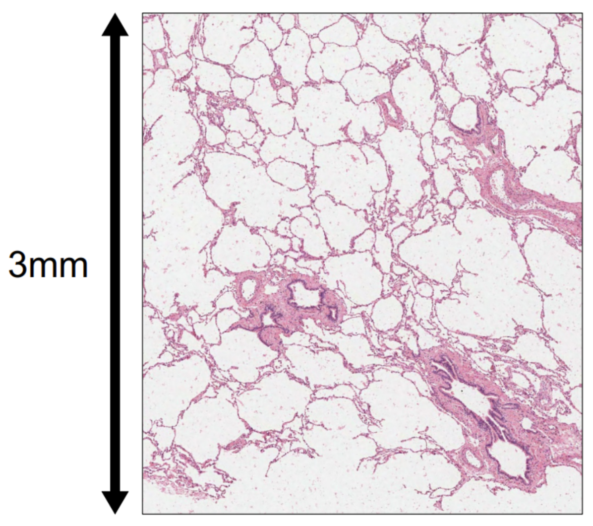 Figure 4. Demonstration of how small-scale tissue biopsy punches are able to recapitulate tissue heterogeneity and relevant biological features in lung. Figure provided courtesy of TGen.