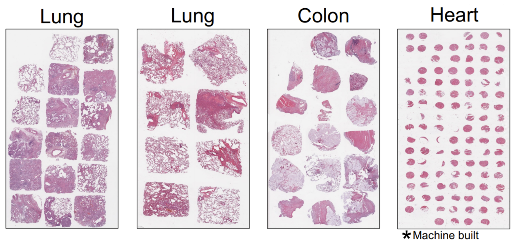 Figure 1. Tissue microarrays taken from a variety of sample sizes and tissue types constructed on Xenium slides. Figure provided courtesy of TGen.