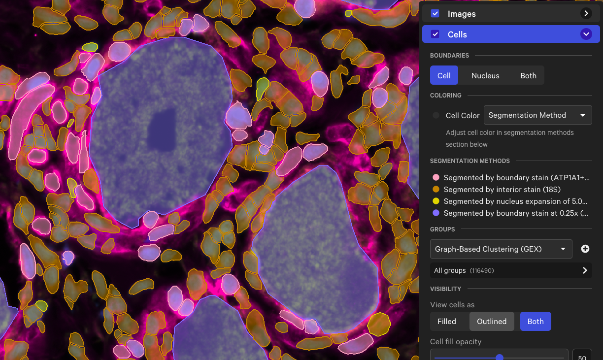 Xenium data from dorsal root ganglion tissue demonstrating segmentation of large neurons. Dataset provided by researchers in Dr. Theodore Price’s laboratory at the University of Texas at Dallas.