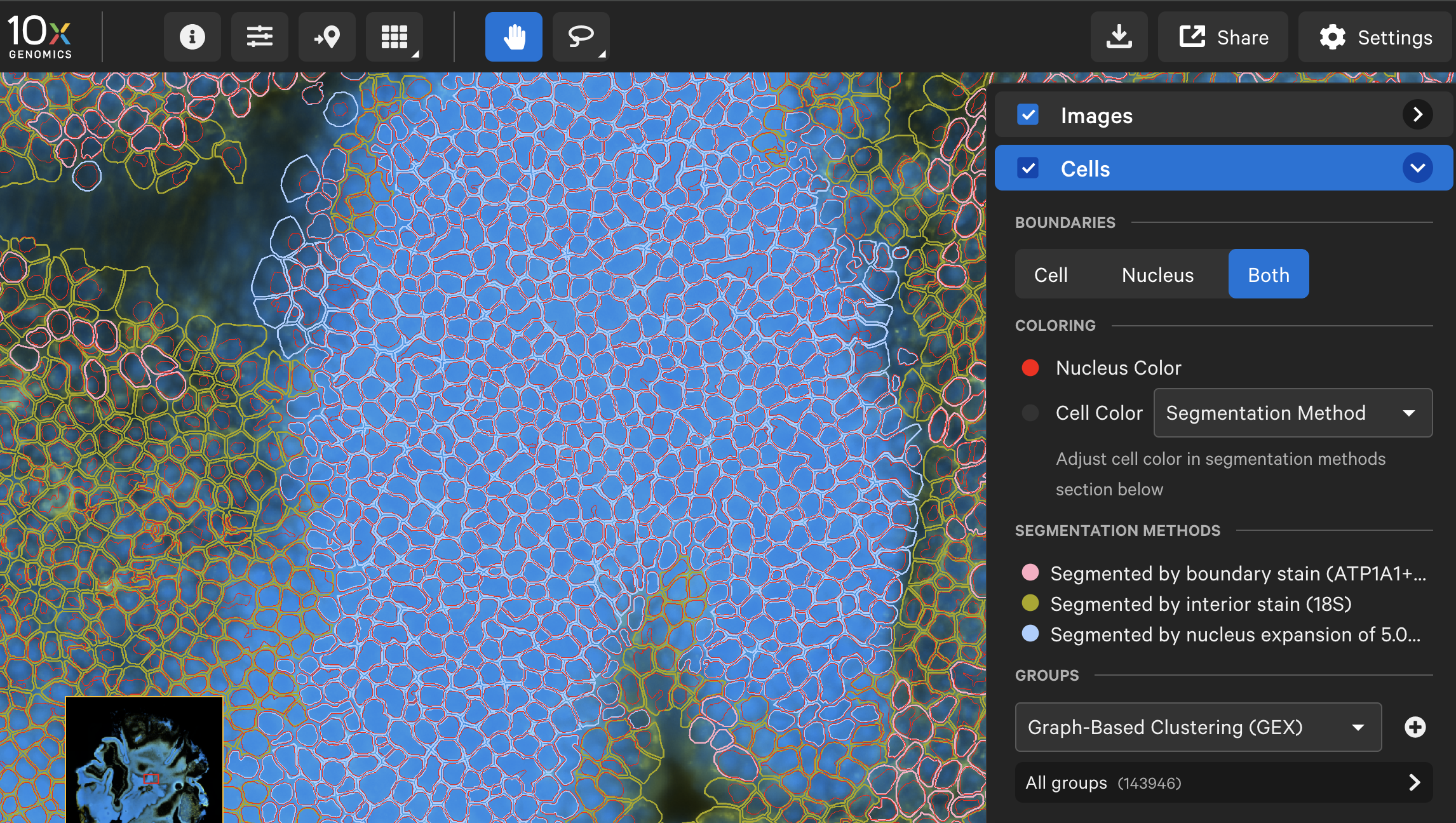 Xenium data from mouse retina demonstrating segmentation of dense nuclei using the Xenium Onboard Analysis v4.0 nucleus segmentation algorithm. Tissue preparation detailed in Budoff S & Poleg-Polsky A. En face cryosectioning of mouse retina for high-dimensional spatial molecular analysis. J Vis Exp  (2025), and Budoff S & Poleg-Polsky A. A complete spatial map of mouse retinal ganglion cells reveals density and gene expression specializations. bioRxiv (2025).