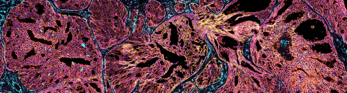 Atera In Situ - Featured Dataset