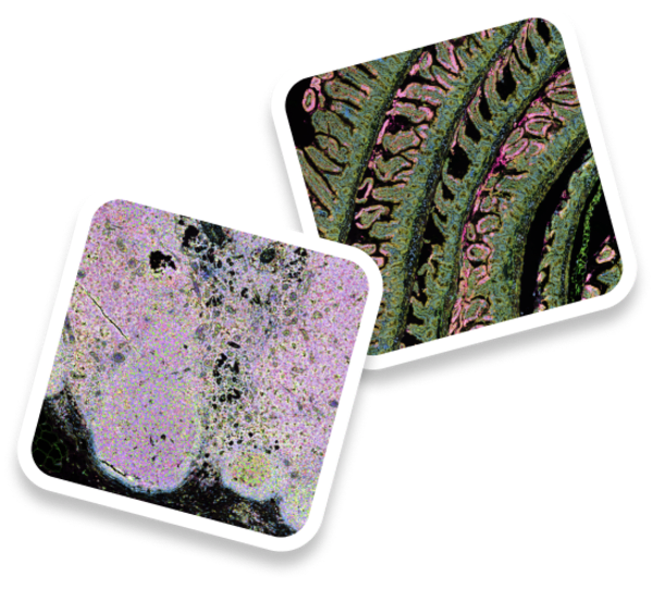 Xenium Protein