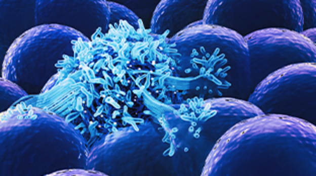 Tumor immune microenvironment interactions