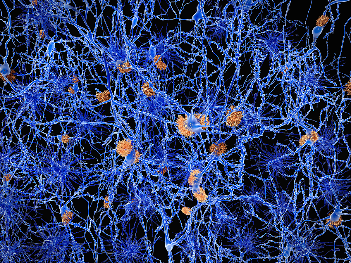 How Alon Millet ID’d the "what" and "where" of a new Alzheimer’s-associated cell type