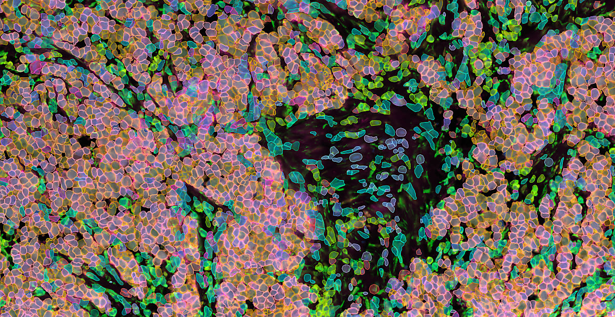 Spatially defined ligand/receptors as potential novel biomarkers for response to immunotherapy
