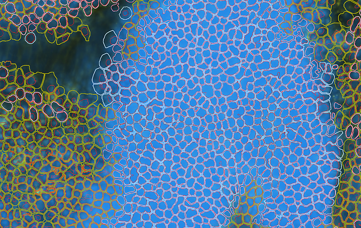 Xenium software improvements that make single cell spatial imaging faster, easier, and more powerful