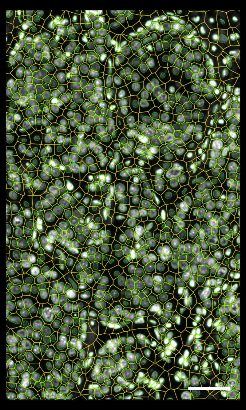 核（緑）および細胞（黄）の輪郭を示すDAPI画像