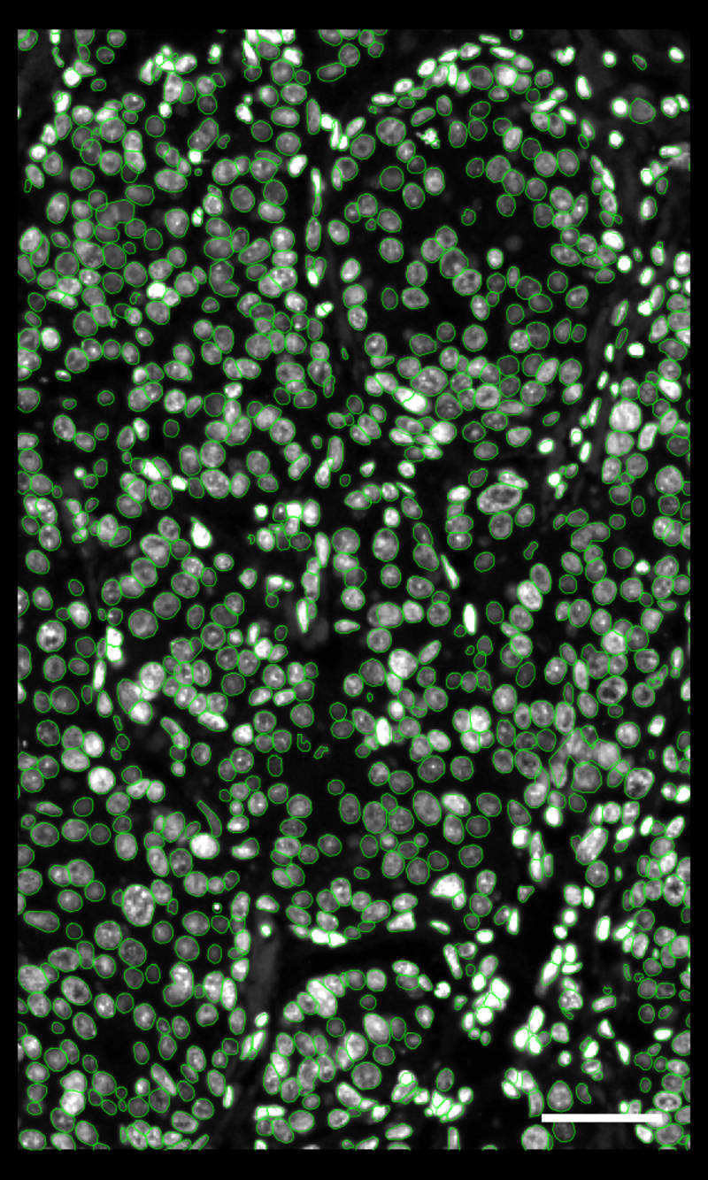 DAPI image with nuclear outlines